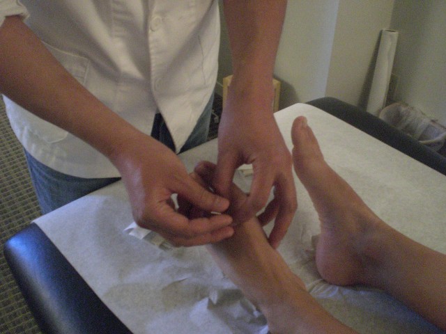 Acupuncture Needle Manipulation